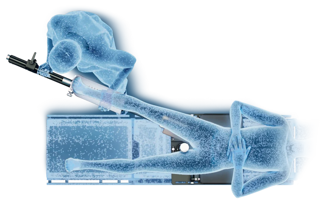 Surgeon operating over a patient utilizing a surgeon controlled patient positioning device from a bird's eye view